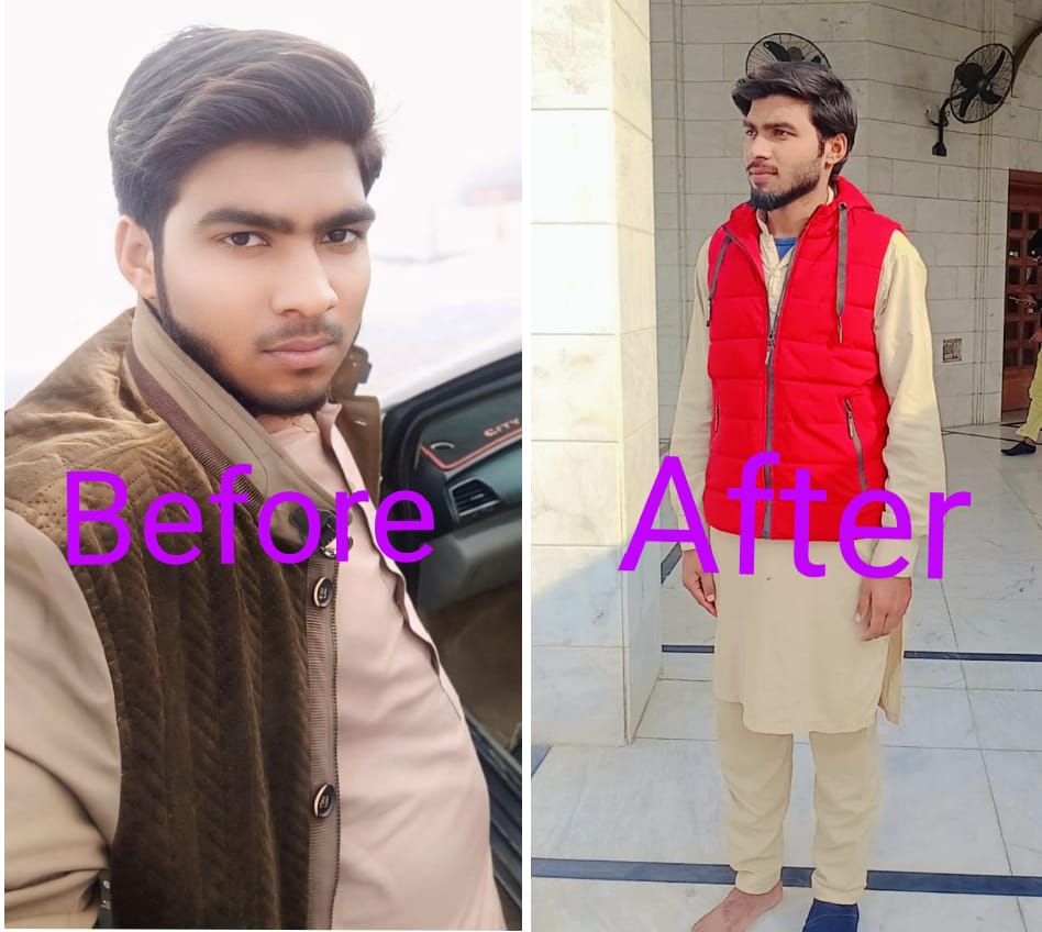 FIT AURA-Weight Loss